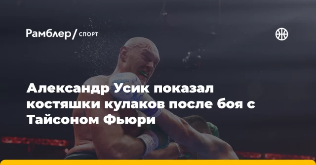 Александр Усик показал костяшки кулаков после боя с Тайсоном Фьюри Александр Усик показал костяшки кулаков после боя с Тайсоном Фьюри