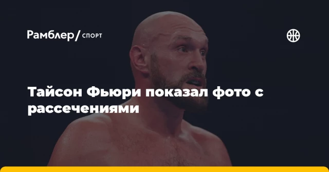 Тайсон Фьюри показал фото с рассечениями Тайсон Фьюри показал фото с рассечениями
